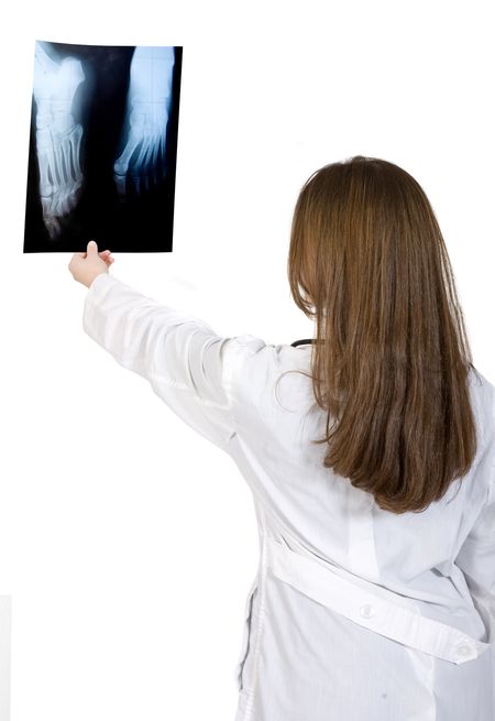 female doctor lokoking at an xray over a white background